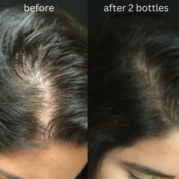 Aisha Organic Hair Growth Oil
